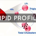 Lipid Profile Test